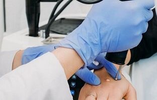 modalități de a elimina negii